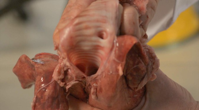 Pluck Dissection